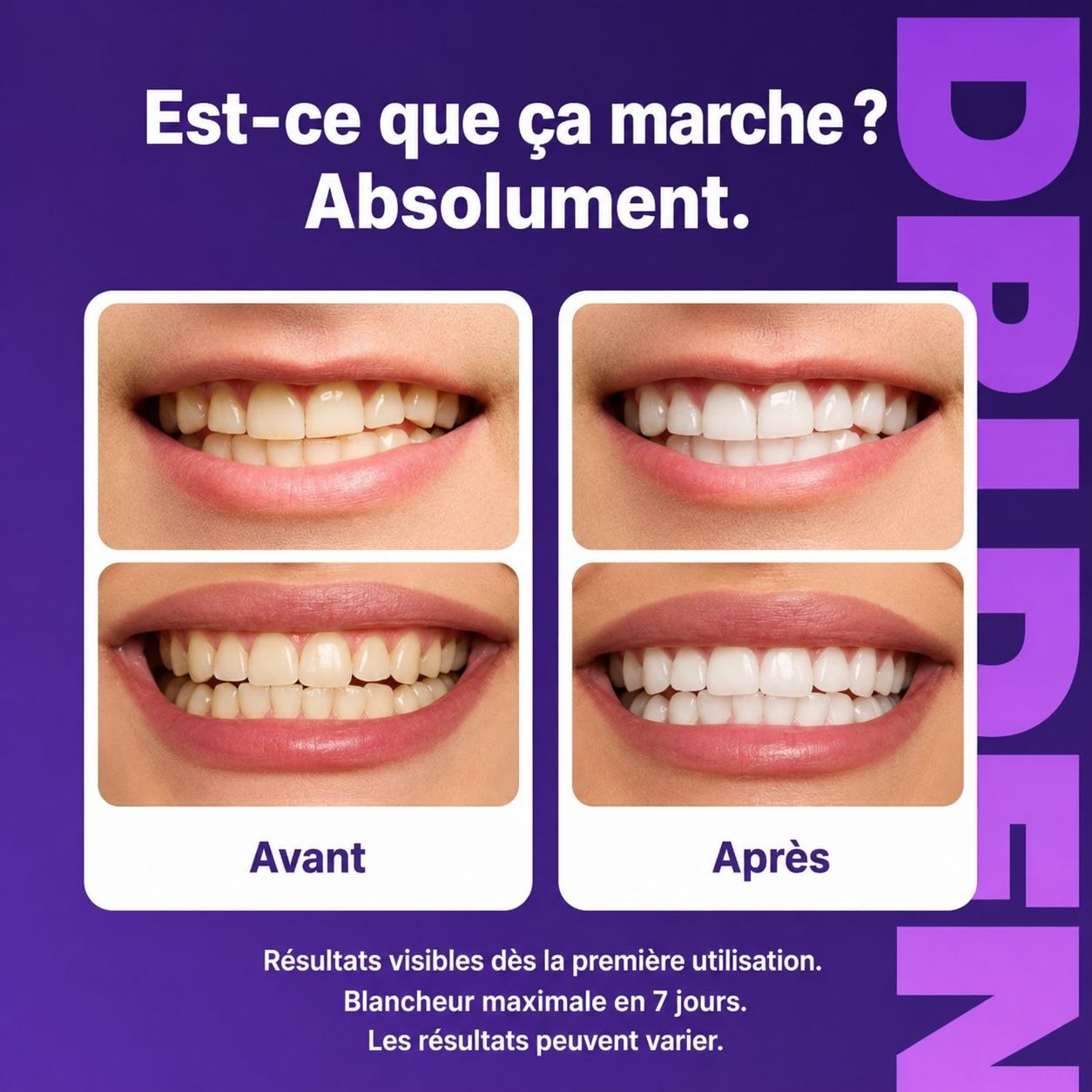 Bandes Blanchissantes Dentaires Dr Dent – Sourire Éclatant